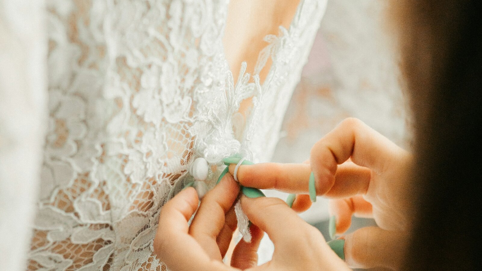 Alterations